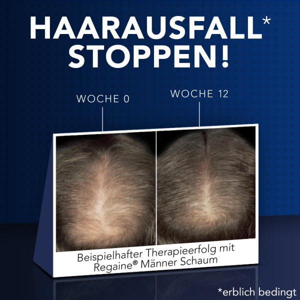 REGAINE® Männer Schaum mit Minoxidil REGAINE® Männer Schaum mit Minoxidil