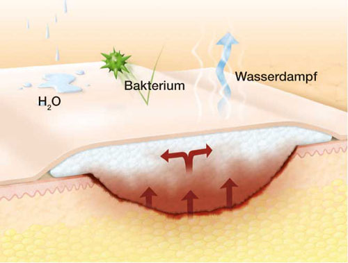 SUPRASORB P sensitive PU-Schaumv.bor.lite 15x20cm SUPRASORB P sensitive PU-Schaumv.bor.lite 15x20cm